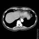 Thorax 48
